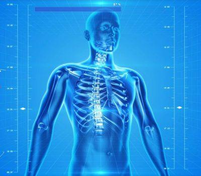 kyphoplasty unique pain medicine new york kyphoplasty unique pain medicine new york