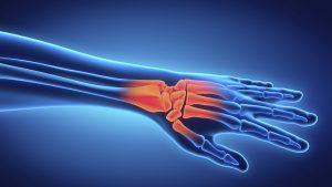 pain management manhattan unique pain medicine pain management manhattan unique pain medicine