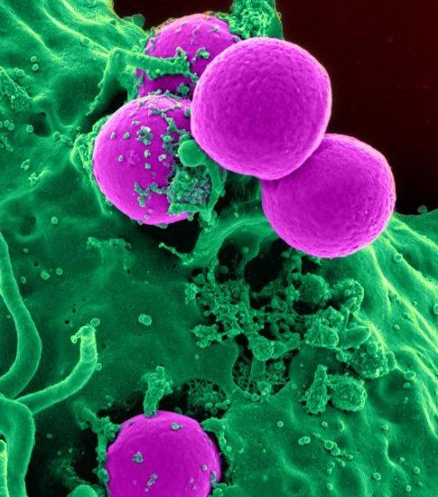 stem cells benefits manhattan stem cells benefits manhattan
