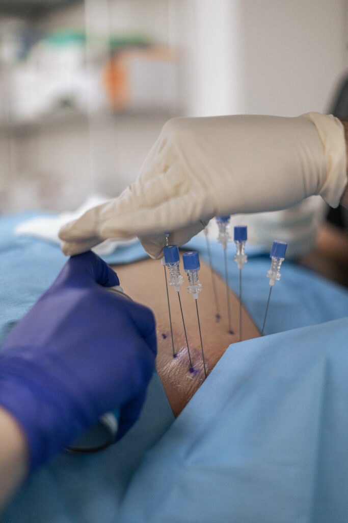 Pain treatments in New York